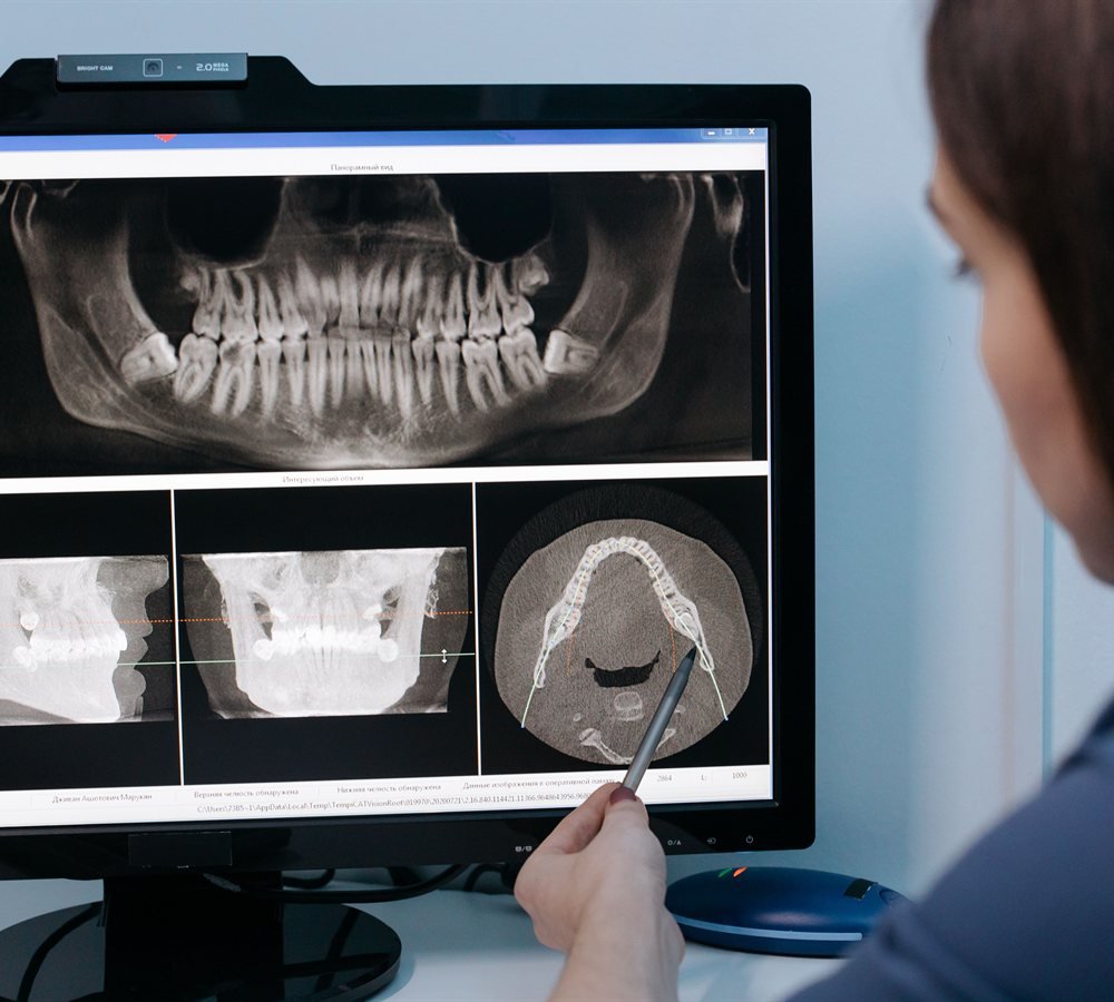 Los Angeles periodontist reviewing gum health with a patient during a consultation