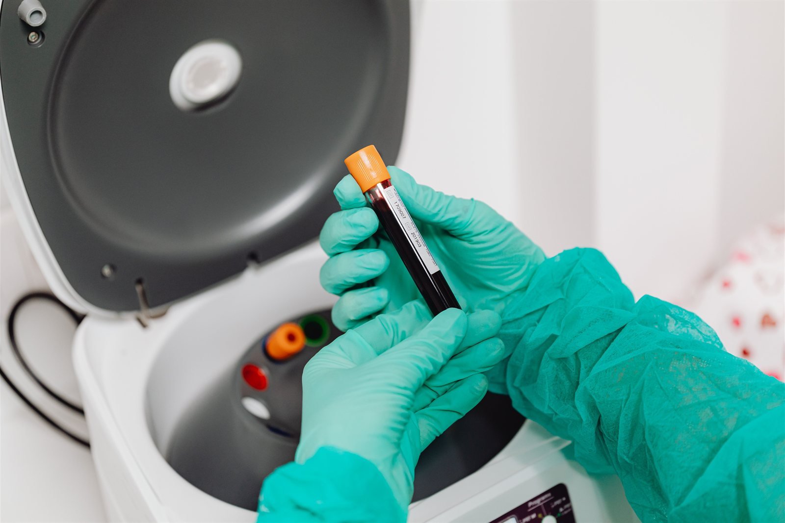 Periodontist preparing platelet-rich plasma therapy at LA Periodontics in Los Angeles
