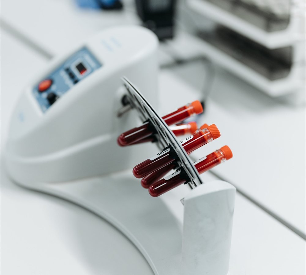 Blood sample being processed for platelet-rich plasma therapy in a centrifuge